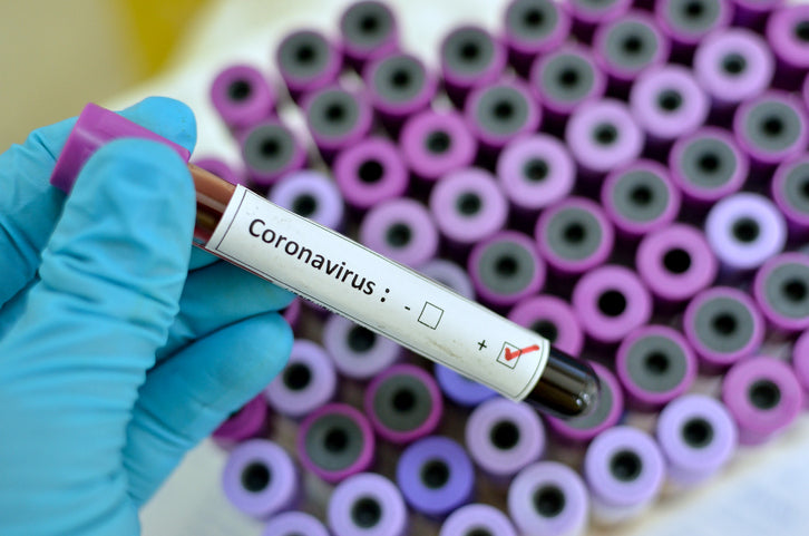 You Can't Catch Coronavirus From Packages